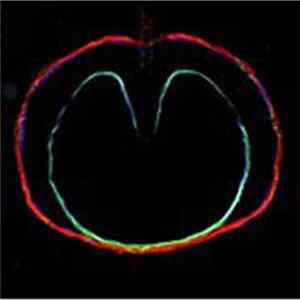 XTC - Wasp Star (Apple Venus Volume 2) Album