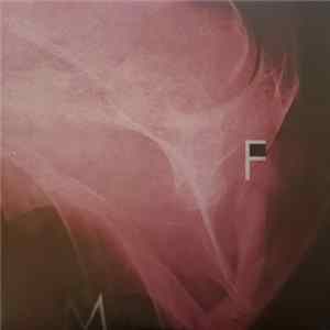 Father Murphy - Pain Is On Our Side Now Album
