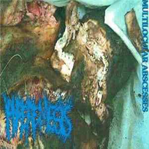 Hyperemesis / Rotocles - Multilocular Abscesses / Mincecore Way Album