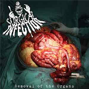 Surgical Infection - Removal Of The Organs Album