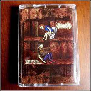 Inopexia - Myocardical Biopsy Had A Lethal Outcome Album