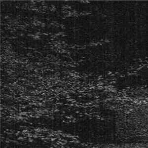 Vestibulum Vacuüi, Mental Decay - Vestibulum Vacuüi / Mental Decay Album