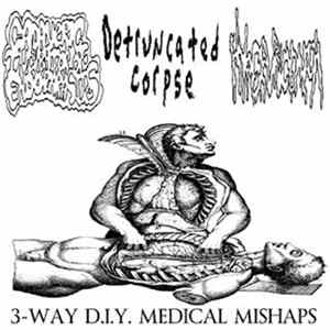 Cadaveric Incubator Of Endoparasites / Detruncated Corpse / Hyperuricemia - 3-Way D.I.Y. Medical Mishaps Album