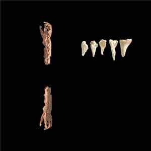 Bee Spit / Vomir - Poignets et des Dents Album