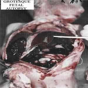 Sulfuric Cautery - Grotesque Fetal Autopsy Album